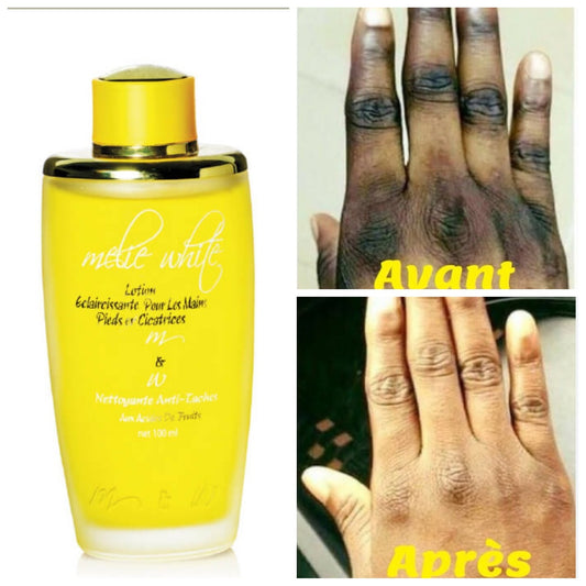 LOTION MELIE WHITE JAUNE ÉCLAIRCISSANTE TONIQUE ANTI TACHES ET CICATRICES